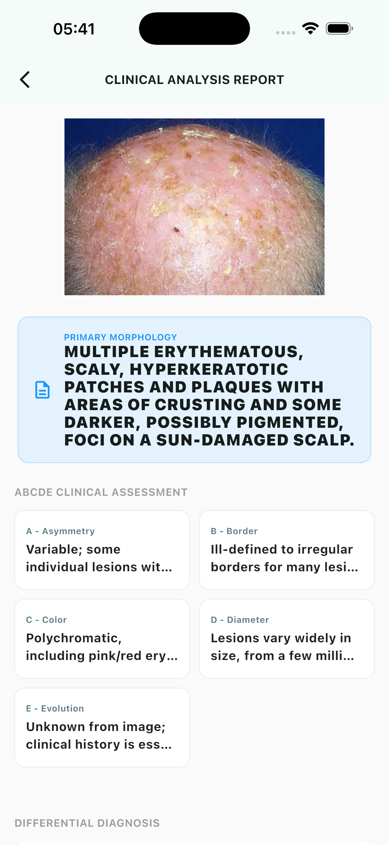 DermWizard AI Image Analysis Results Screen